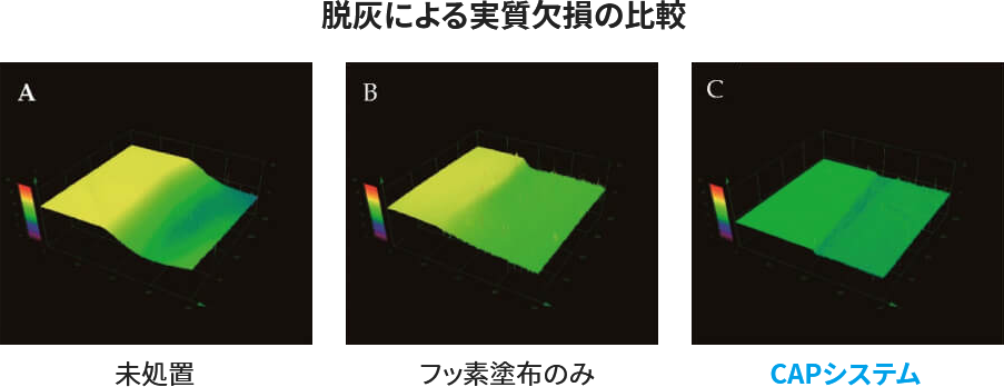脱灰による実質欠損の比較