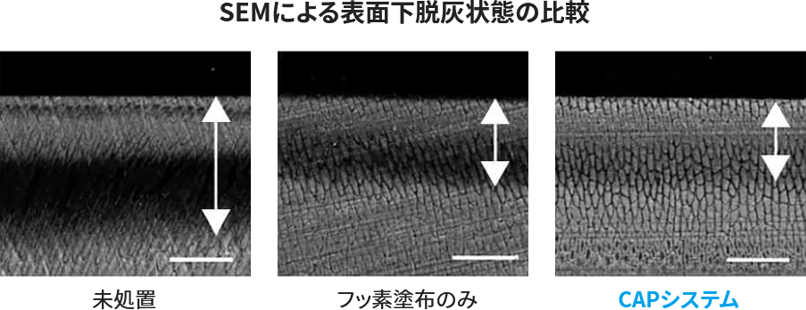 SEMによる表面下脱灰状態の比較